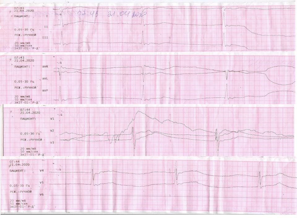 Description: C:\Users\Максат\Downloads\fIGURE 1-140.jpg