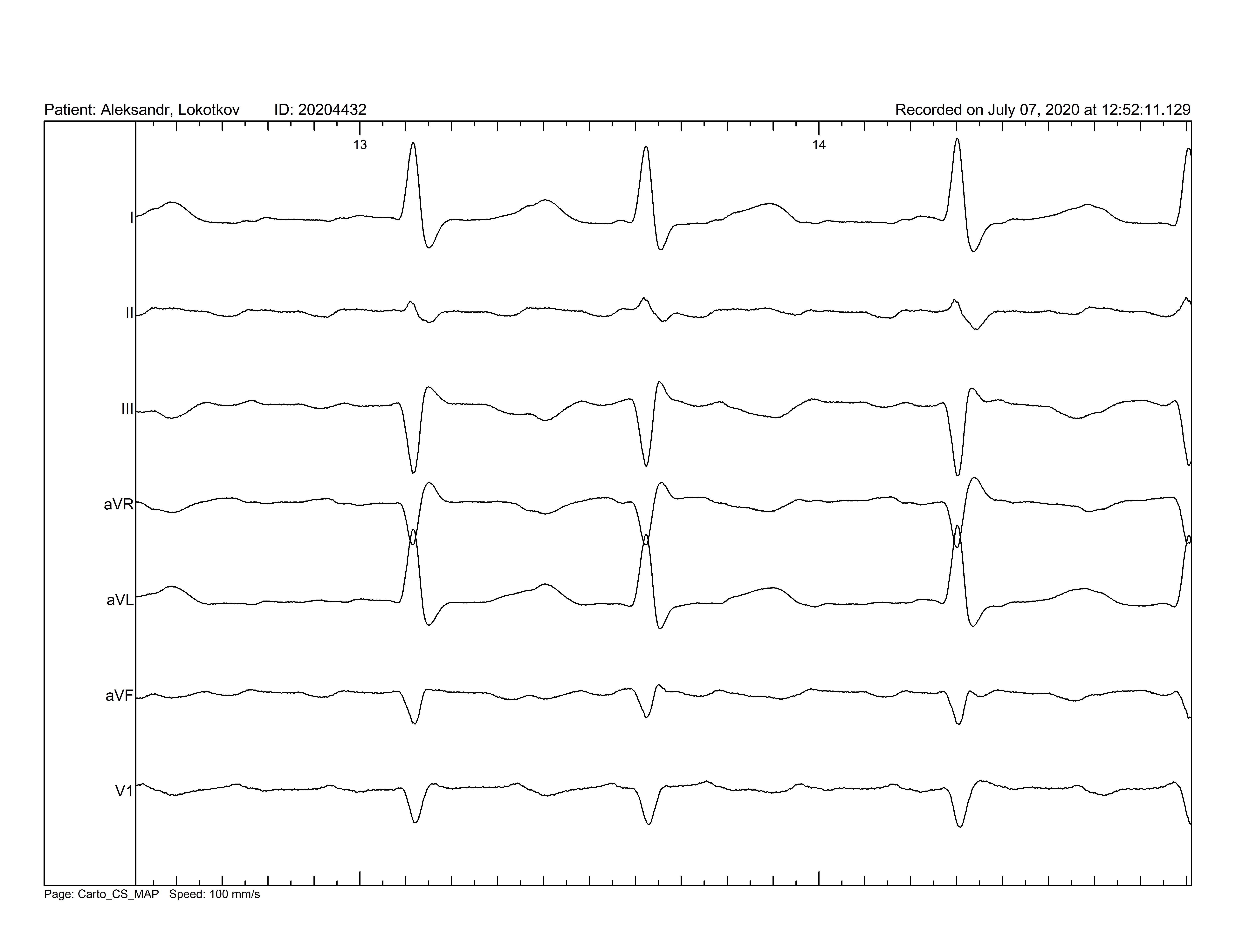 Description: Description: ECG.jpg